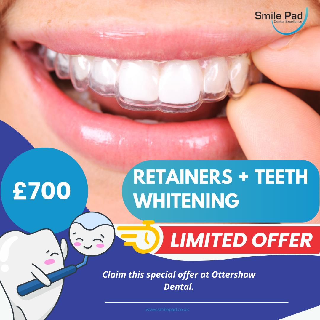 retainers